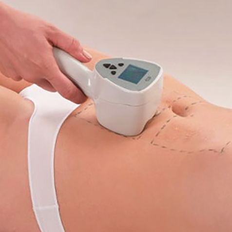 Treat cellulite with our Exilis Ultra 360™ at SF Bay Cosmetic Surgery Medical Group in San Ramon