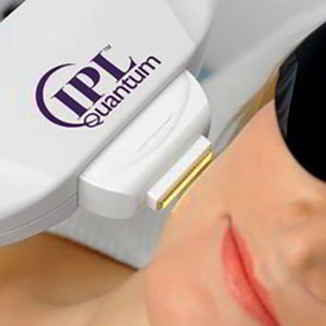 Treat Scarring with our IPL Photo Facial at SF Bay Cosmetic Surgery Medical Group in San Ramon