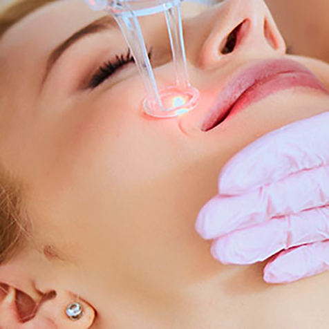 Treat Fine Lines with our UltraPulse® CO2 at SF Bay Cosmetic Surgery Medical Group in San Ramon